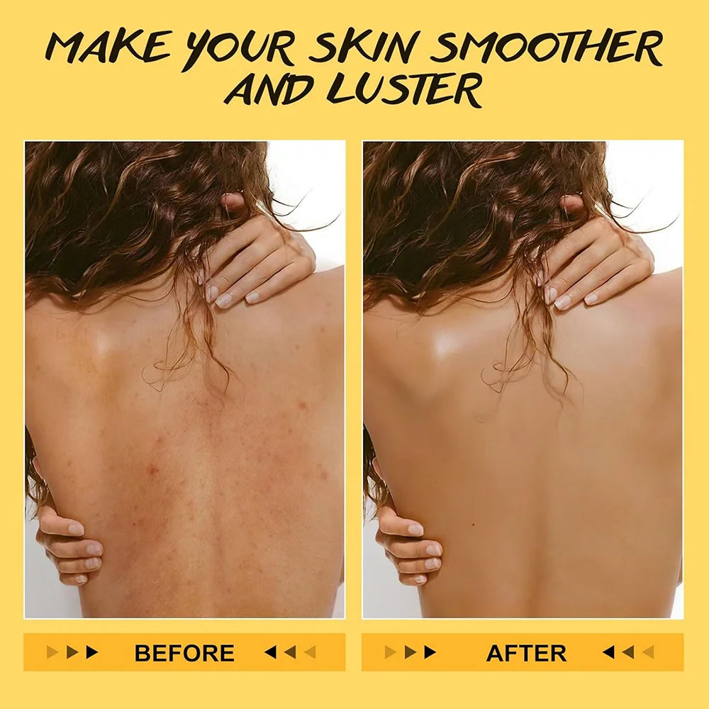 Esfoliante corporal