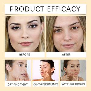 Cleasing Oil - Óleo de Limpeza, Removedor de Maquiagem e Hidratante Facial