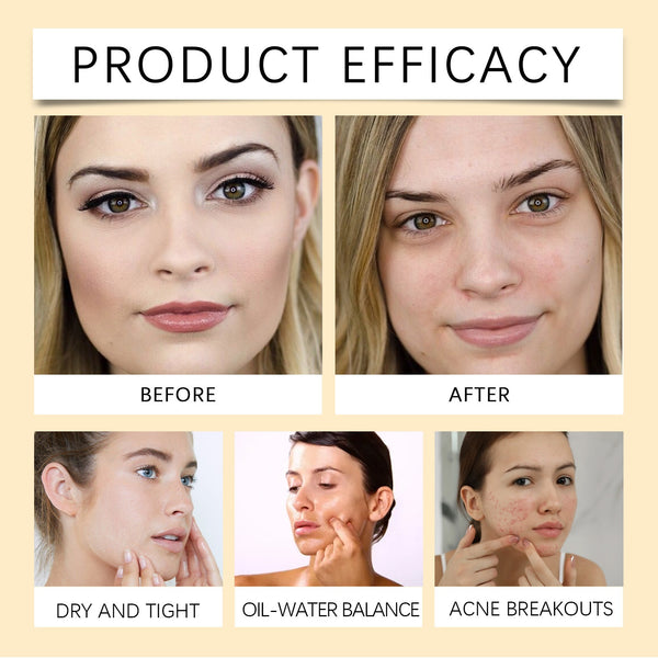Cleasing Oil - Óleo de Limpeza, Removedor de Maquiagem e Hidratante Facial